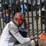 2 September 2019: A South African street trader who makes a living selling cosmetics on the sidewalk was beaten bloody by a large xenophobic mob who rampaged through Joburg’s inner city, looting and attacking stores and street traders along the way.